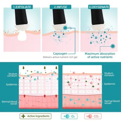 Appareil de soin du visage 3 en 1 à nano-bulles – image 2