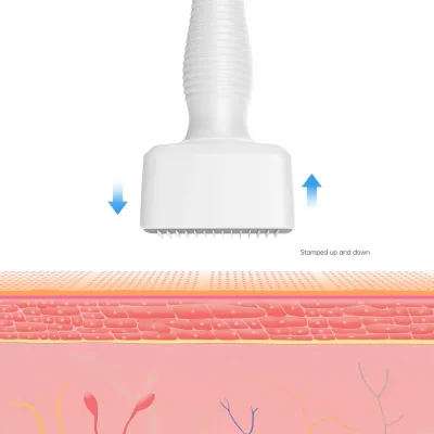 Derma stamp blanc à 140 aiguilles réglables – image 3