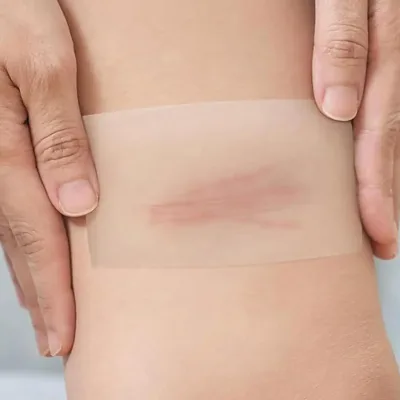 Rouleau de pansement hydrocolloïde à découper – image 3